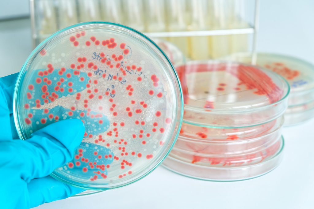 Σηπτικό σοκ: Ποιες βακτηριακές λοιμώξεις μπορούν να το προκαλέσουν – Συμπτώματα που πρέπει να προσέξετε