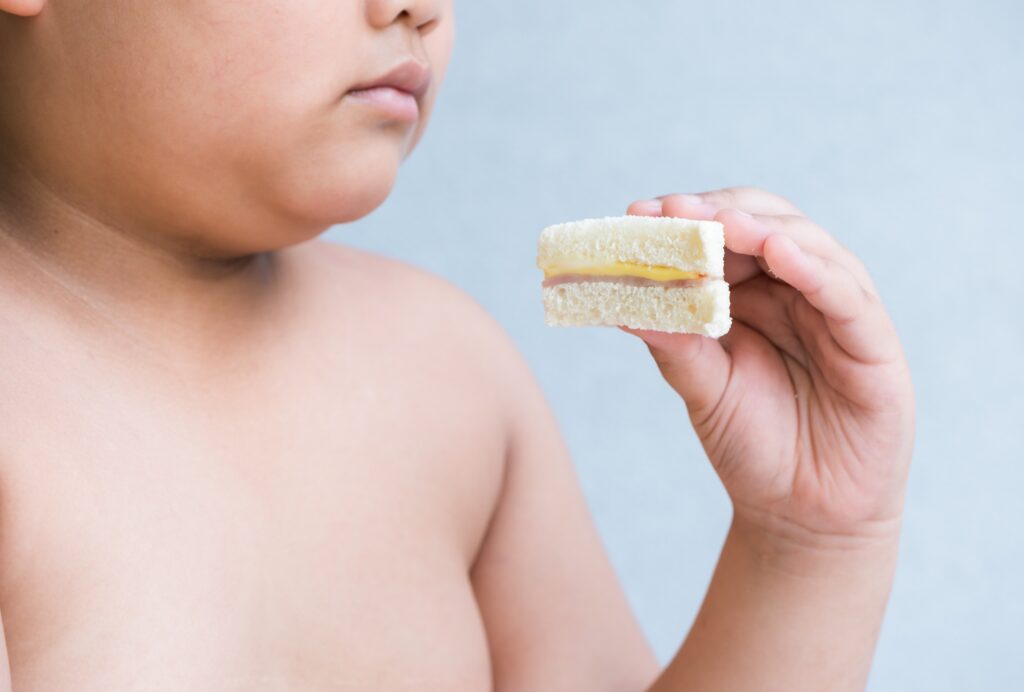 Παιδίατροι: Το πρόγραμμα για την αντιμετώπιση της παιδικής παχυσαρκίας παρουσιάζει μεγάλες αδυναμίες